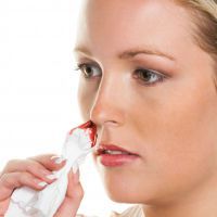 Носовое кровотечение и первая помощь